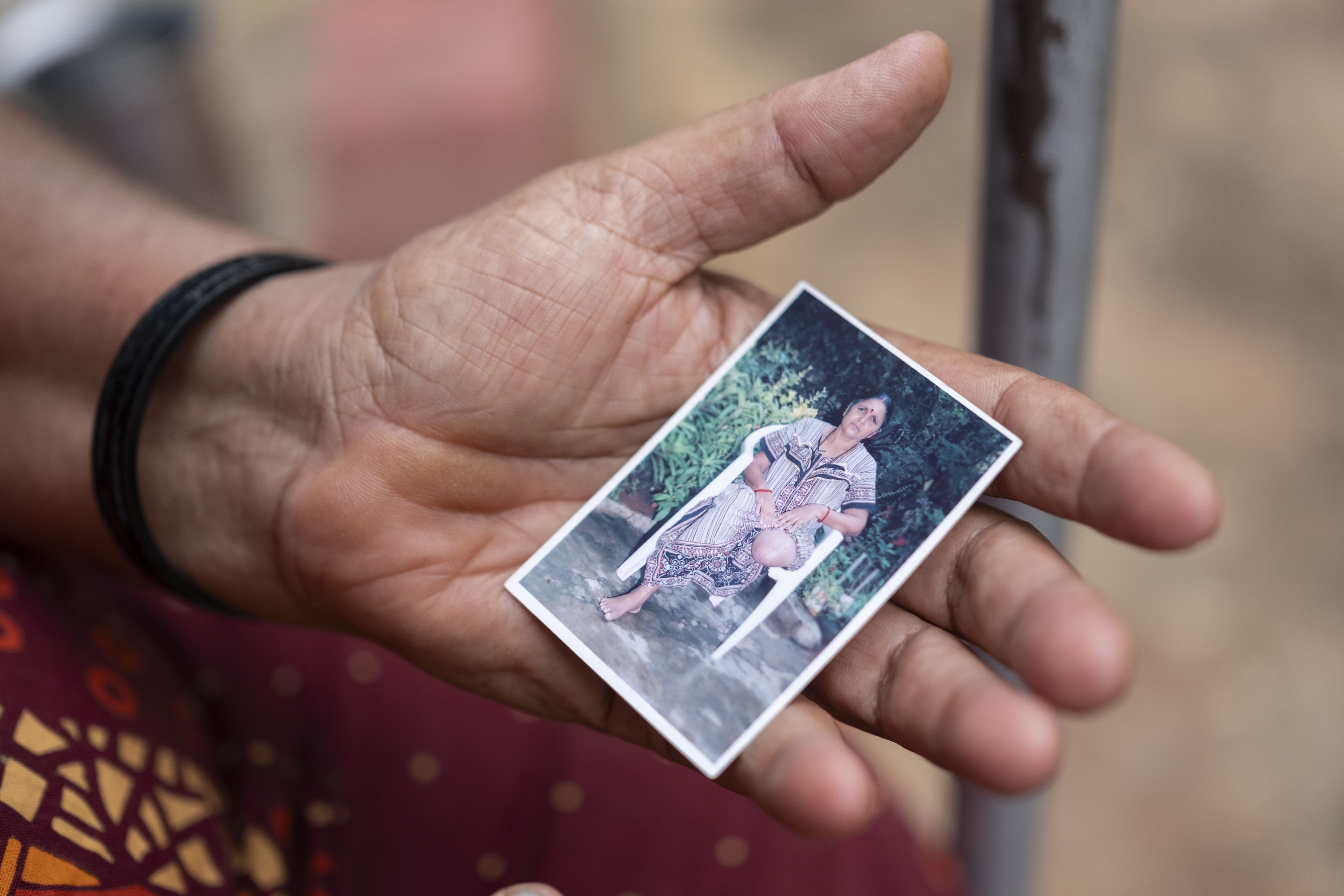 Rani, snakebite survivor and amputee, Chowdikatte village, Karnataka, India. Rani holds a photo of herself after a Russell’s viper bite while picking beans led to medical complications that necessitated the amputation of her leg. Eighteen years later, she continues to experience pain in what remains of her limb.